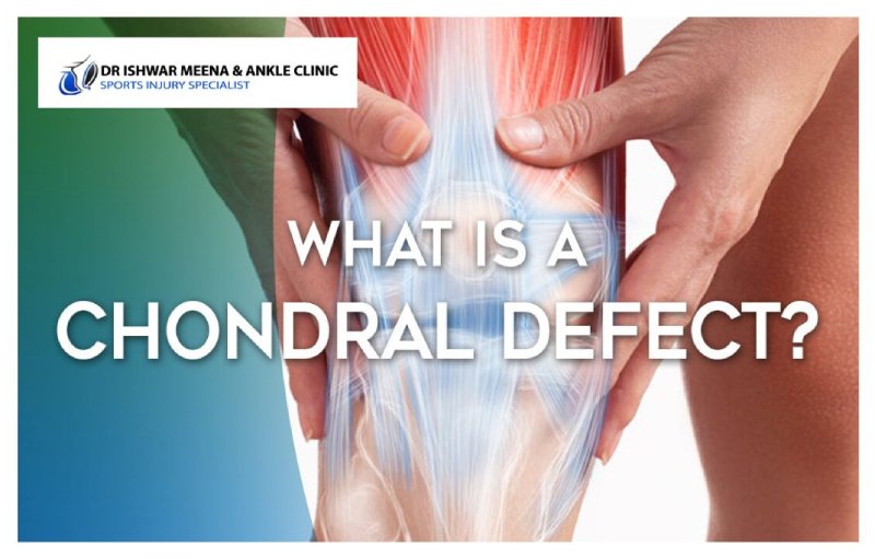 Image of a knee with cartilage and ligament structures visible, asking 'What is a Chondral Defect?' Dr. Ishwar Meena & Ankle Clinic logo is displayed