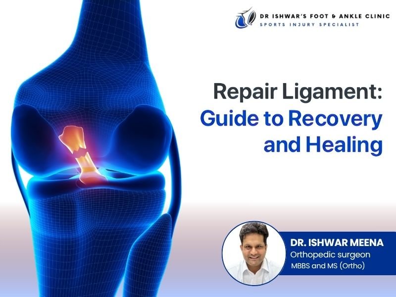 Illustration of a torn knee ligament with highlighted injury area, featuring Dr. Ishwar Meena, Orthopedic Surgeon, and the title "Repair Ligament: Guide to Recovery and Healing.